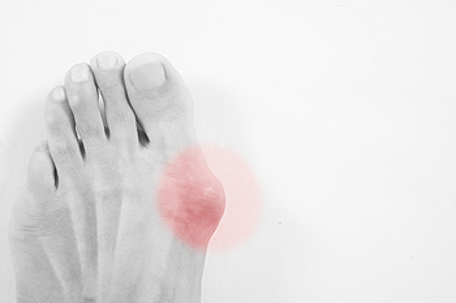 sore hard skin on side of big toe